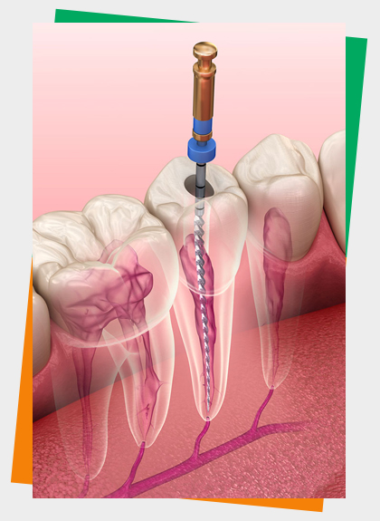 Endodontics