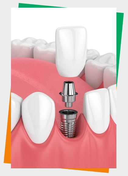 Prosthodontics