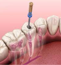 Endodontics