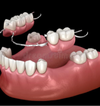 Prosthodontics