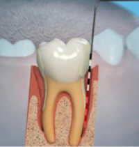 Periodontics