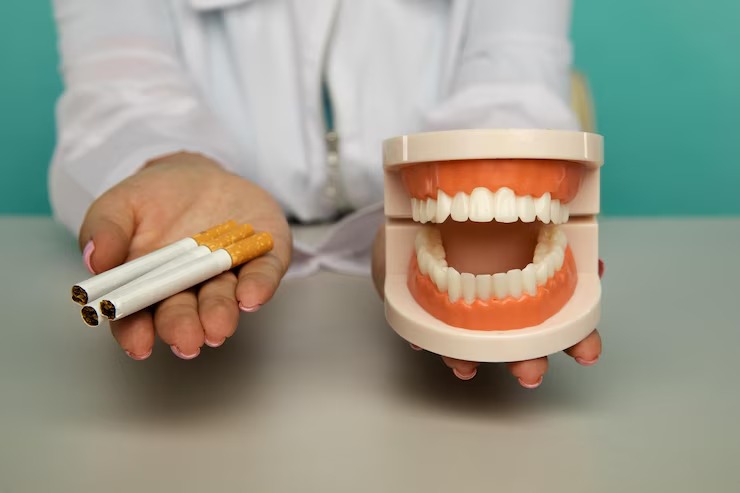 Smoking’s Impact on Teeth and Gums